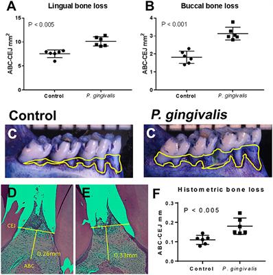 A Uniquely Altered Oral Microbiome Composition Was Observed in Pregnant Rats With Porphyromonas gingivalis Induced Periodontal Disease